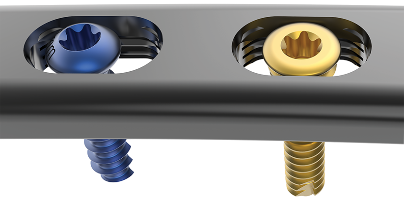 Distal radius plate screws