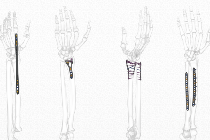 Wrist & Forearm Set