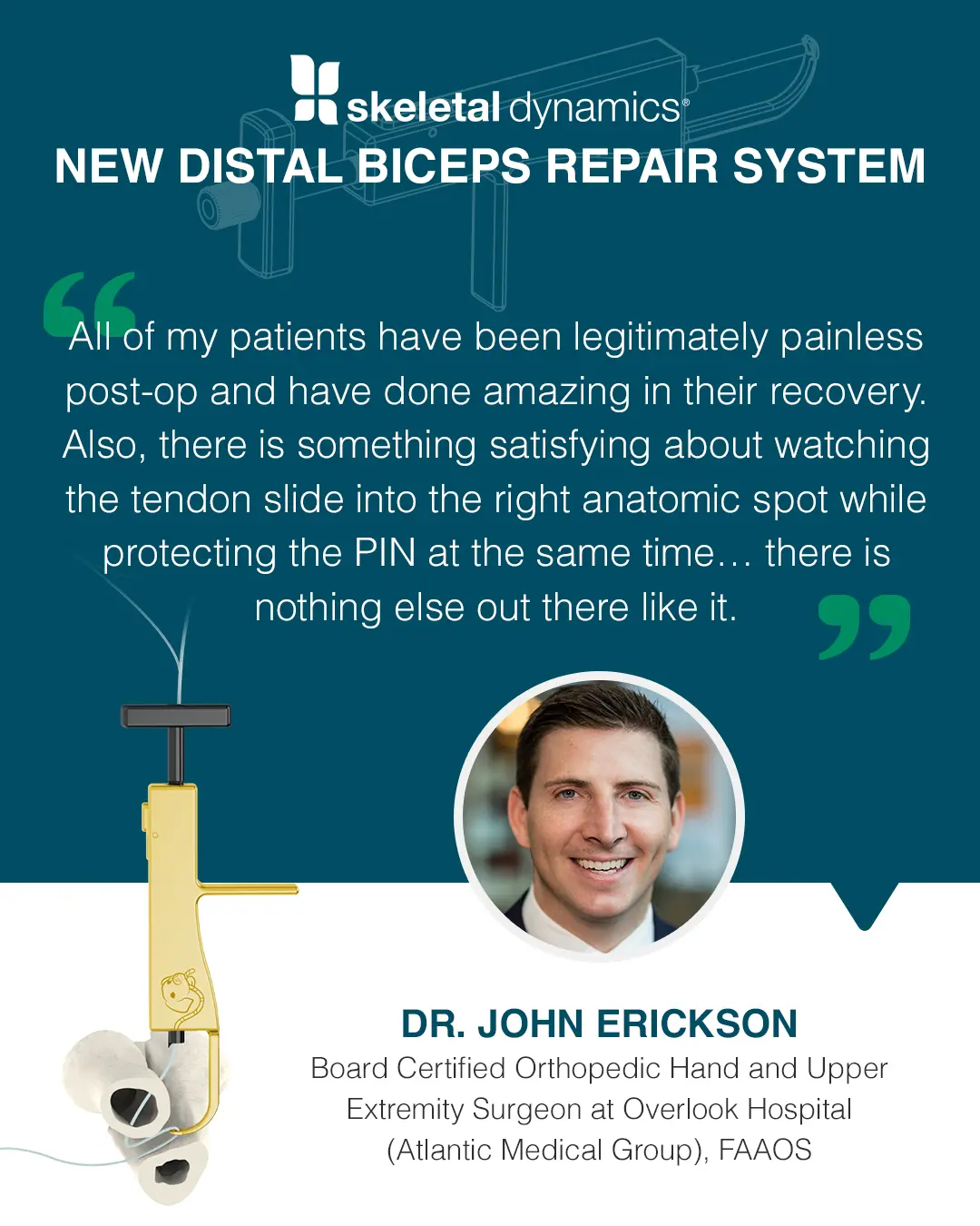 Dr. John Erickson distal biceps repair system quote