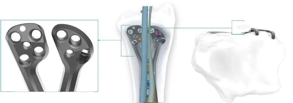 GEMINUS Diagram