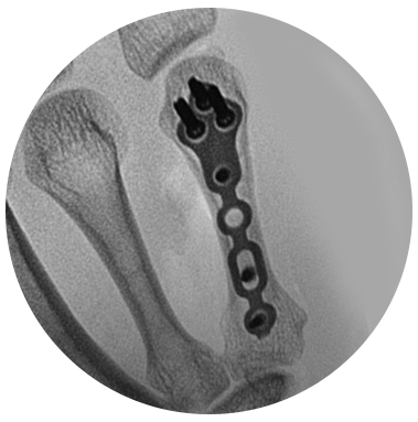 Protean hand plating system