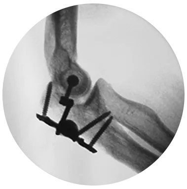 IJS® X-Ray