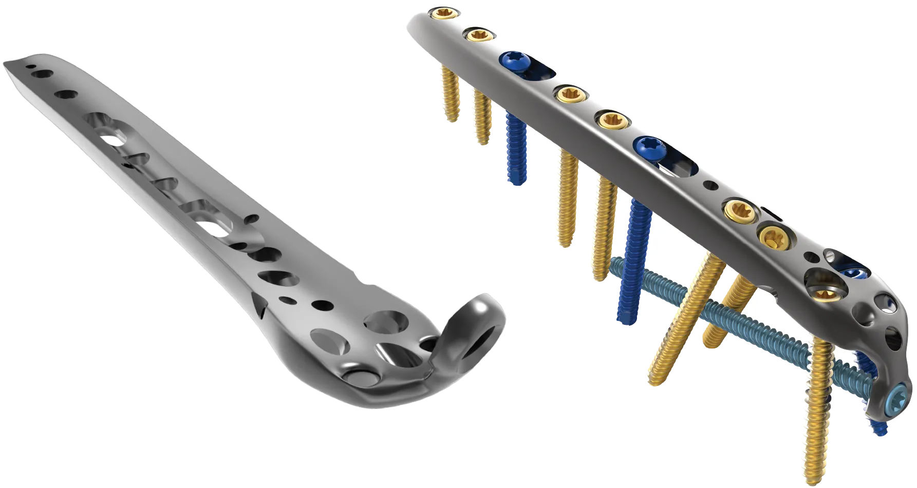 Proximal Ulna Plate technology diagram, with labels to the deepended central concavity, suture holes, single home run tab, and suture anchor points.