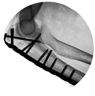 PUP X-Ray