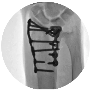 PROTEAN® Fragment Plates xray