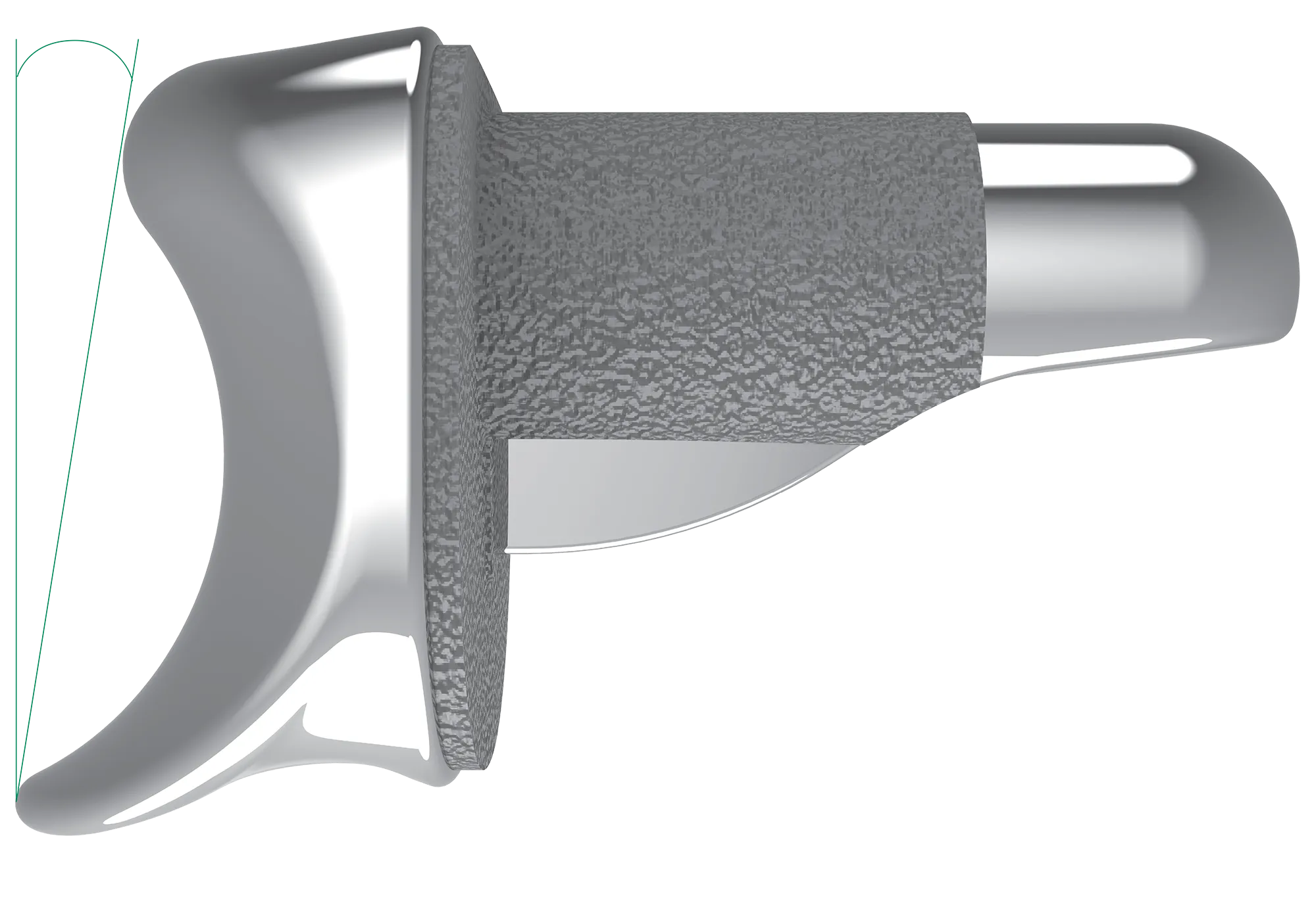 The saddle-shaped implant for a saddle-shaped joint