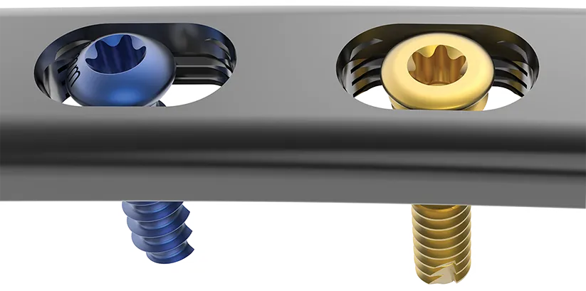 Both compression and locking screws can be inserted in any position in FREEFIX® slots