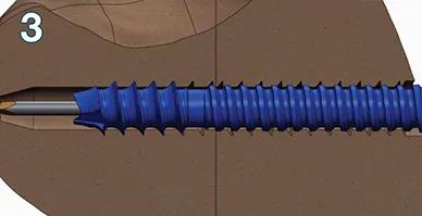 Central section clutch provides translation