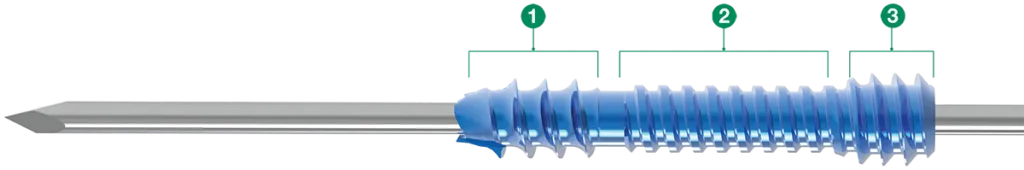 Labeled diagram of tool that provides the needed fragment approximation and only 1mm of reproducible compression