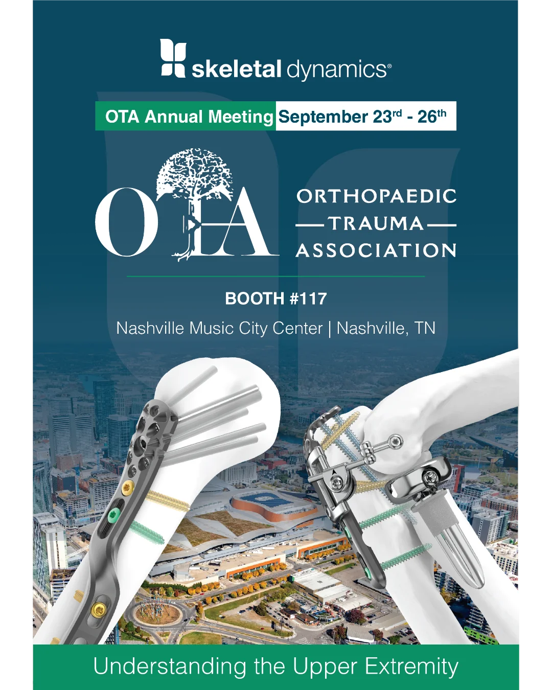 Skeletal Dynamics will be at the 2026 OTA annual meeting in Nashville, TN